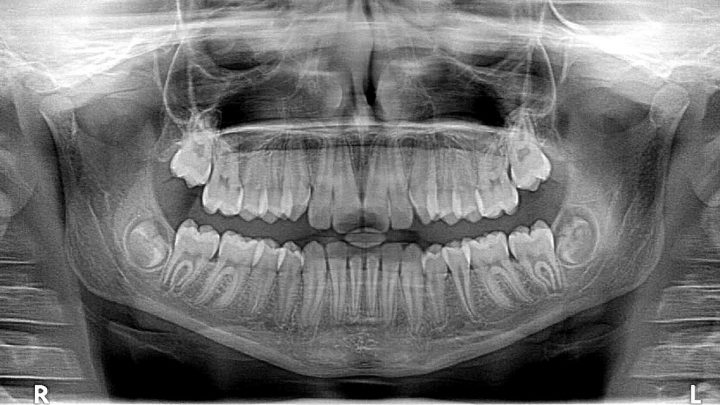 Nowoczesna protetyka stomatologiczna