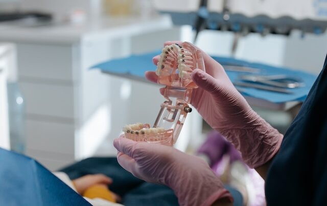 Zabiegi chirurgiczne i wybielanie zębów