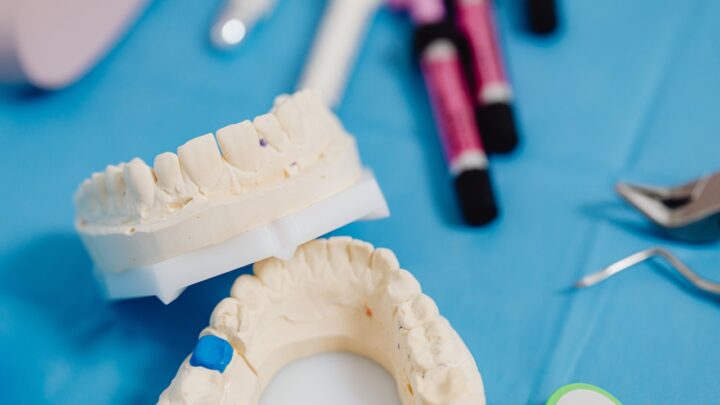 Metody bondingu zębów – przywróć piękny uśmiech