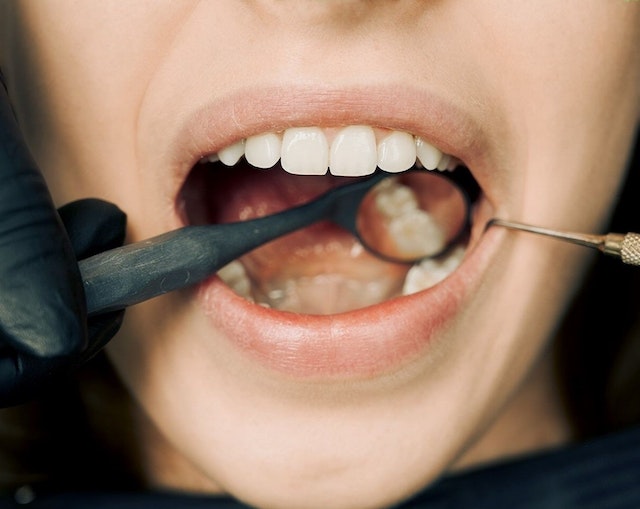 Czym jest dłutowanie zęba i do czego się je wykorzystuje?