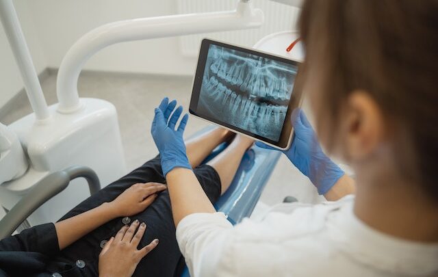Rentgen zębów – Nowoczesna diagnostyka
