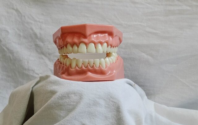 Jak stomatologia estetyczna pomaga w utrzymaniu białych zębów?