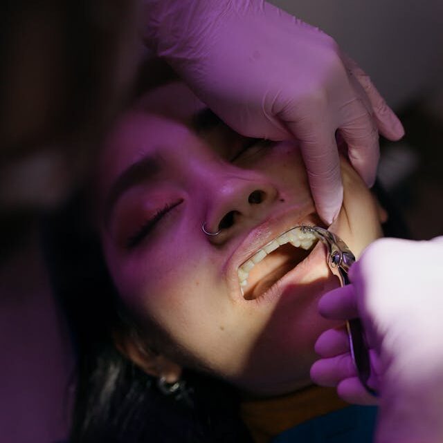 Z czego składa się aparat ortodontyczny?