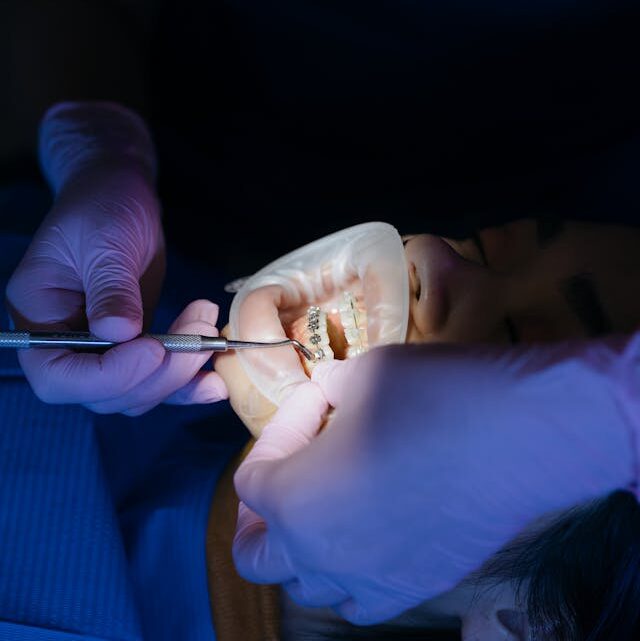 Jakie wady zgryzu można wyleczyć aparatem ortodontycznym Hyrax?