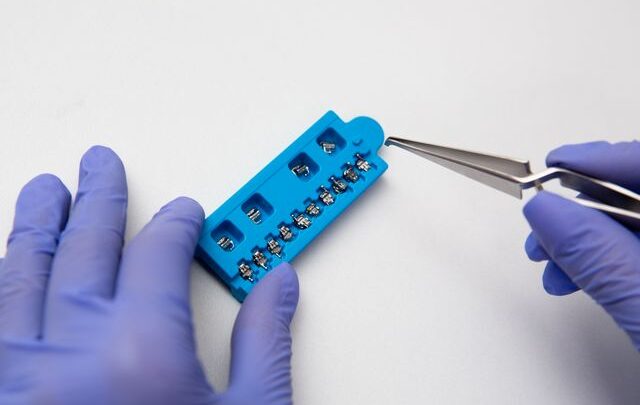 Ile trwa przyzwyczajenie się do aparatu ortodontycznego?