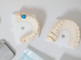 Czym różni się protetyk od dentysty ogólnego?