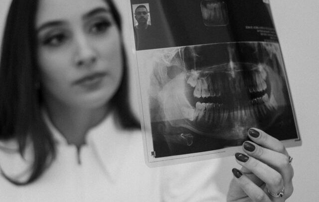 Pantomogram stomatologiczny – co pokazuje i kiedy się go wykonuje?