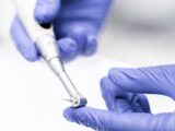 Podniesienie dna zatoki szczękowej – na czym polega zabieg?